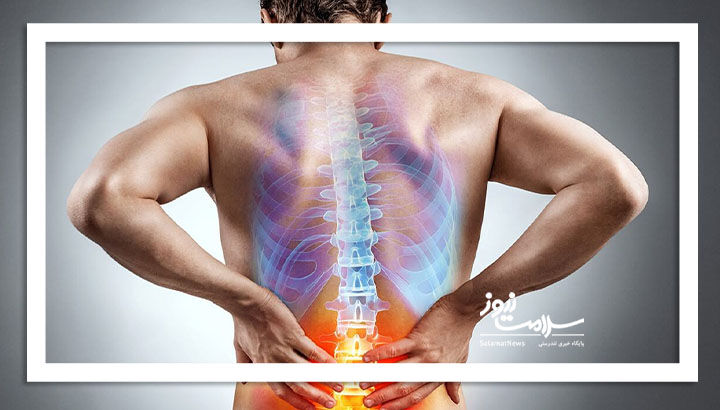 دیسک کمر همیشه نیاز به جراحی ندارد
