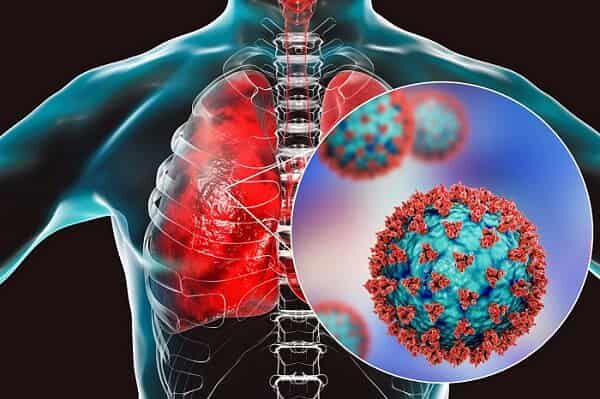 روند شیوع عفونتهای تنفسی در سال جاری ثابت است با تأکید بر اهمیت رعایت بهداشت
