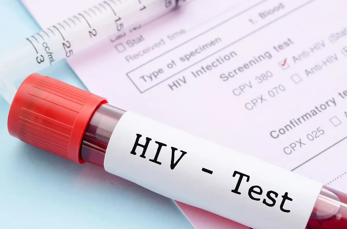 ترکیب دارویی نوین برای کنترل ویروس HIV در بیماران مقاوم به درمان